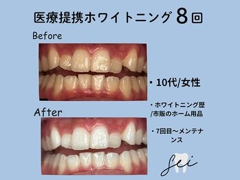 セイ(sei)/症例写真　ビフォーアフター