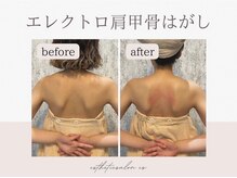エステティックサロン シーズ/肩甲骨はがし×ほぐし