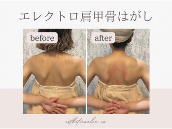 エステティックサロン シーズ/肩甲骨はがし×ほぐし