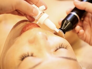 マリスレジーナ 新保店(MarisRegina)の写真/韓国美容の決定版【小顔コルギ＋韓国リジュラン導入★60分￥6980】ほぼ痛みなし♪速攻小顔＆ツヤ肌を実感！