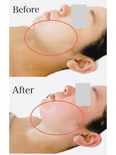 リブ 三軒茶屋(LiB)/ボディ＆フェイス瞬時ライン変化