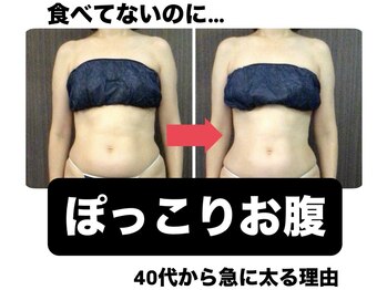 バーテックスキー(Vertexkey)/なぜかぽっこりお腹