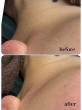 アンドエミニー エン ラボーテ(& EMINY 艶 la beaute)/美肌Wax脱毛