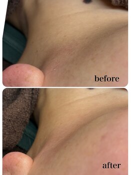 アンドエミニー エン ラボーテ(& EMINY 艶 la beaute)/美肌Wax脱毛