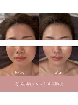 デラッセ(Delasser salon)の写真/モデル・著名人御用達小顔矯正＃有福小顔メソッドで柔らかい表情の小顔を目指す