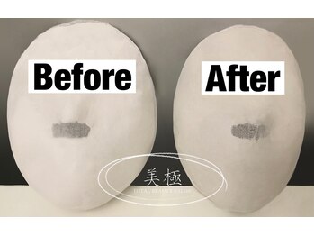 美極 銀座店/銀座/小顔コルギ/小顔矯正