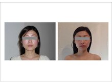 アゴラ/【小顔】豊富な施術実績有り