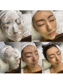 ラフォーレ(raffoleR)/顔のメンテナンスしてますか?