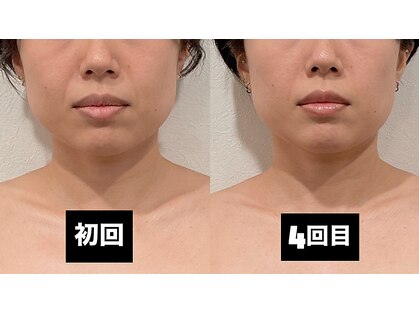 オリナサツキ(OlinaSatsuki)の写真