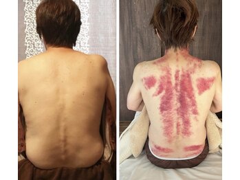 リュクス(Luxe)/　ビフォーアフター(５0代)