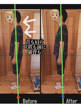 はまもと整骨院/整体・姿勢改善