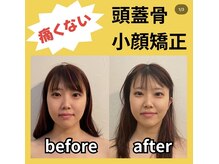 グレースフィオーレ モラージュ柏店(gracefiore)/【ヘッドスパ】ビフォーアフター