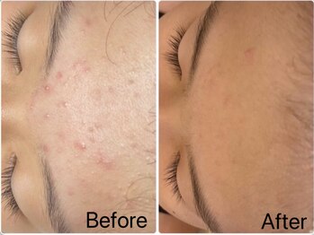 スウィート リリー(Sweet Lily)