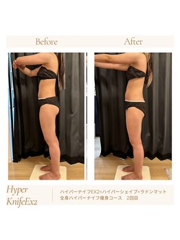 パチュプチ(Patchou petit)/before→after/痩身