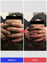 シェルター(Shelter)/小顔矯正ヘッドスパスパ