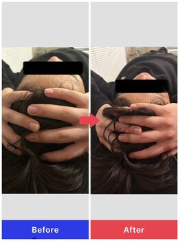 シェルター(Shelter)/小顔矯正ヘッドスパスパ