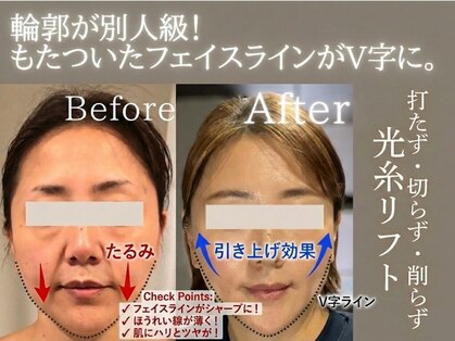 ディオネの写真