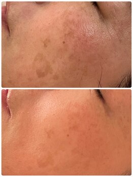 ソリシア(SORISIA)/