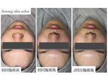 サラン スキンサロン(Sarang skin salon)/