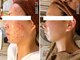 ピリナ 名古屋の写真