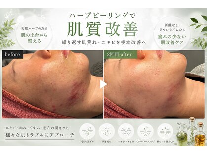 ブルーシー(BLUESEA)の写真