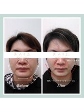 美人ヶ丘/ヘッドスパ,小顔矯正,マッサージ