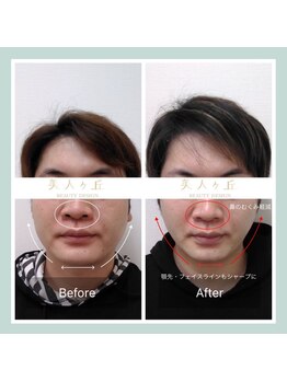 美人ヶ丘/ヘッドスパ,小顔矯正,マッサージ