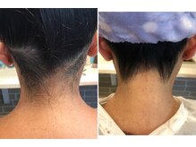 フィッツワン(フィッツONE)/うなじも綺麗に！