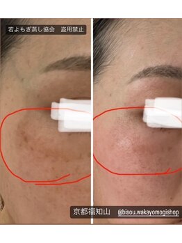 ビエン(美艶 b.en)/若よもぎ蒸し/美肌プレミアム