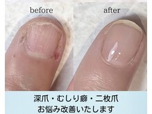 ラーナ ブルー(Rana Blue)の雰囲気（自爪の土台から形を変える☆自爪育成ジェルネイル）