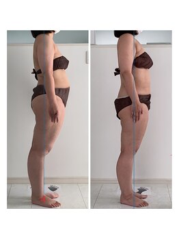 シューライフ(Syu-Life)/４０代女性/ダイエット