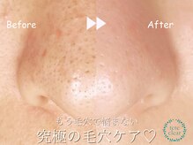 モエラビューティーサロン(Moela beauty salon)