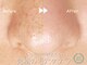 モエラビューティーサロン(Moela beauty salon)の写真