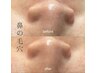【毛穴の悩み】洗浄＋吸引＋ビタミンC導入＋－7度冷却パック  80分  ¥7700
