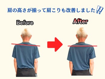アオ(ao)/整体 Before→After