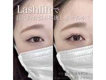 ビーティー(bT)/