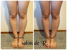 サロン ド アール(salon de R.)/【脚足骨氣・20代・施術効果】