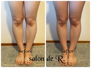 サロン ド アール(salon de R.)/【脚足骨氣・20代・施術効果】