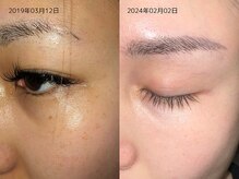 レイル(REIR)/ホームケア：肌質改善プログラム