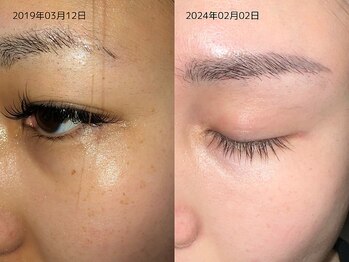 レイル(REIR)/ホームケア:肌質改善プログラム