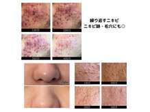ビューティーケア(beauty care)