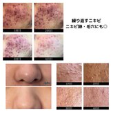 ビューティーケア(beauty care)