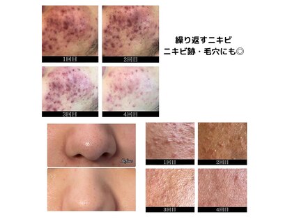 ビューティーケア(beauty care)の写真