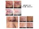 ビューティーケア(beauty care)の写真