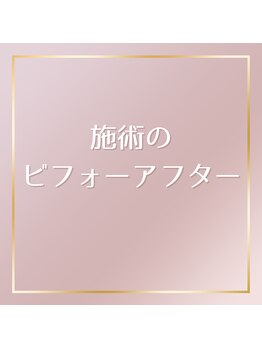 ほねつぎ 平成けやき通り鍼灸接骨院/施術後の変化がこれだけでます!