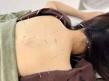 フラット(flat)/施術風景/ボディケア鍼灸