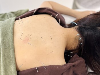 フラット(flat)/施術風景/ボディケア鍼灸