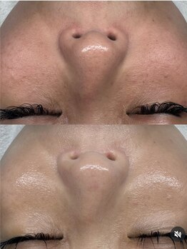 プレジャー 大手町本店(Pleasure)/【ノーファンデアンプル】