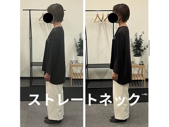 カワル整体 長嶺院/ストレートネック