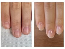 エン(en)/ジェル育成【クリア仕上げ】